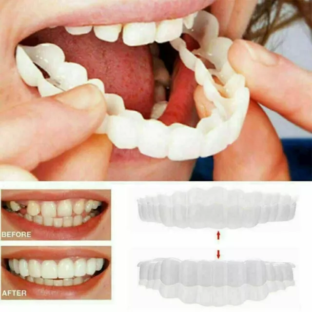 False Teeth Veneers Cover Top & Bottom Instant Cosmetic Clip Up Perfect Smile UK