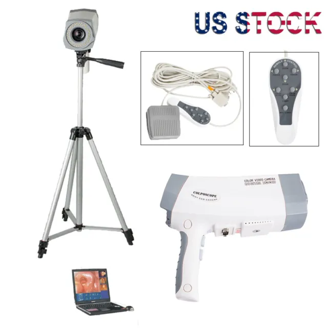 800,000 pixels Video Electronic Colposcope Gynecology EndoVaginal&Tripod Medical
