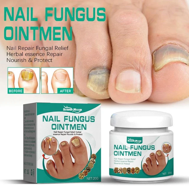 NAIL FUNGUS FUNGAL Removal Cream Treatment CareOnychomycosisInfection