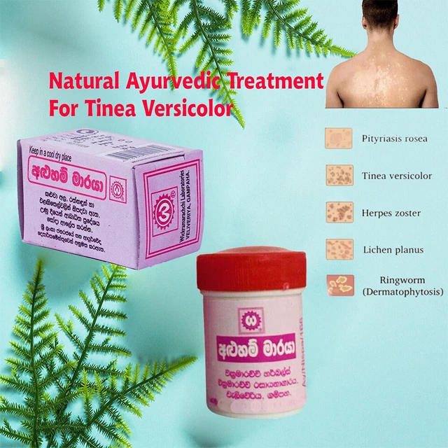 TINEA VERSICOLOR ANTIFUNGAL Relief Pityriasis Cream Treat Skin Rash
