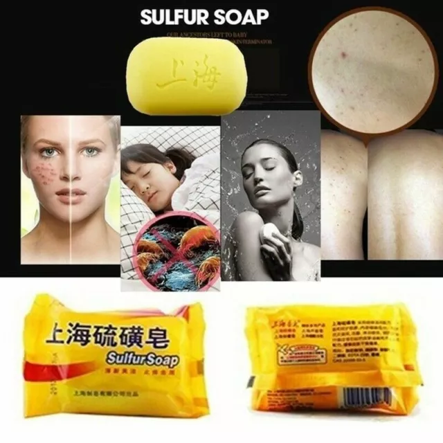 Sulfur Soap Oil Control Acne Treatment Soap Whitening Cleanser Skin Care Health 3