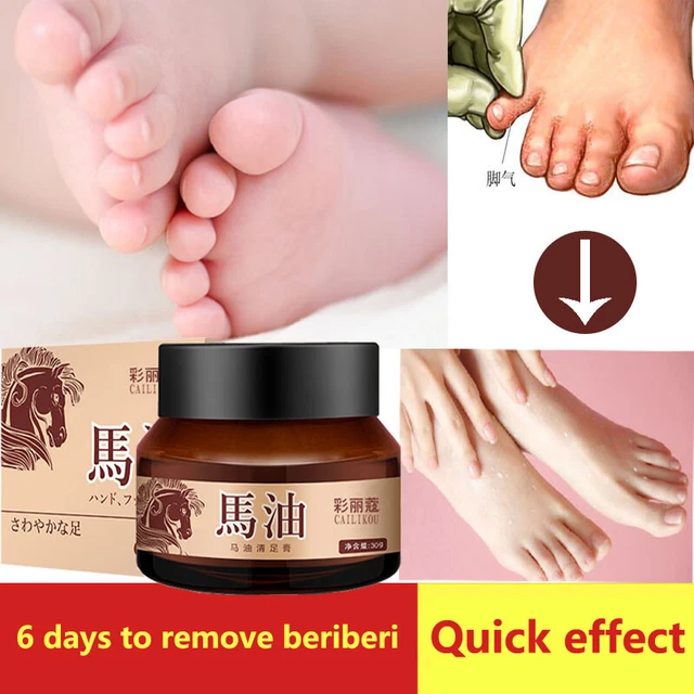 horse oil athlete foot cream quick and effective to remove foot odor itchy fe ql