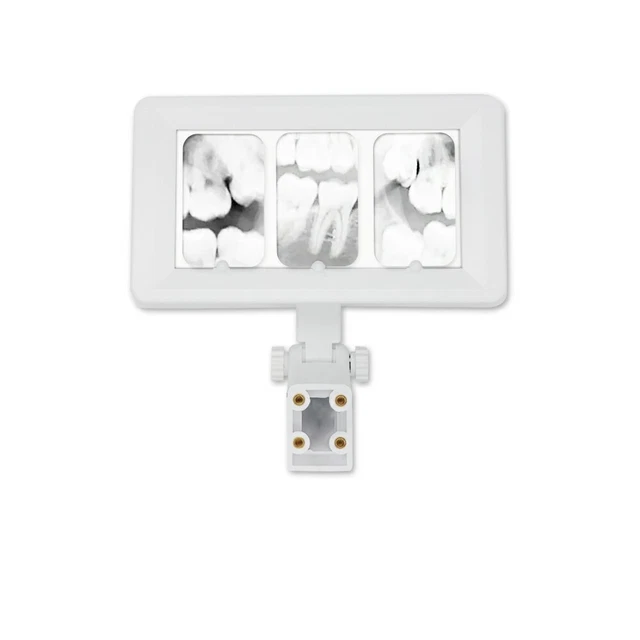 Dental Equipment X-Ray Film Illuminator Light Box X-ray Viewer Light Panel