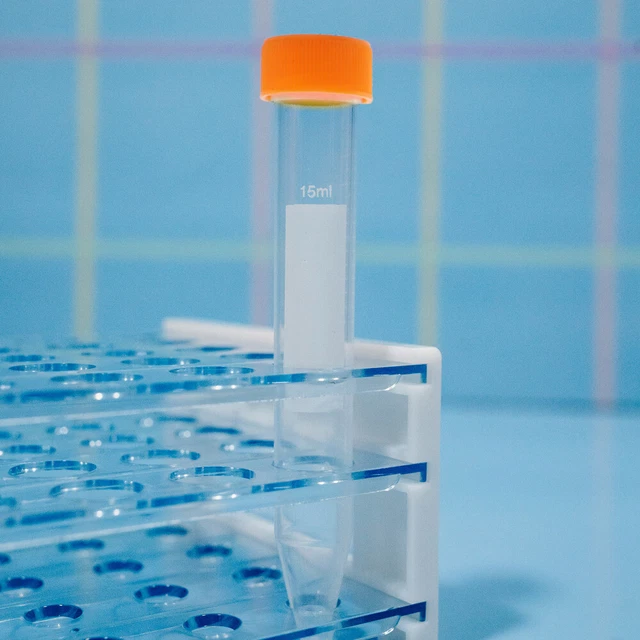 50 Pcs Liquid Test Tubes Centrifuge Tube Glass Lid Candy Containers Screw