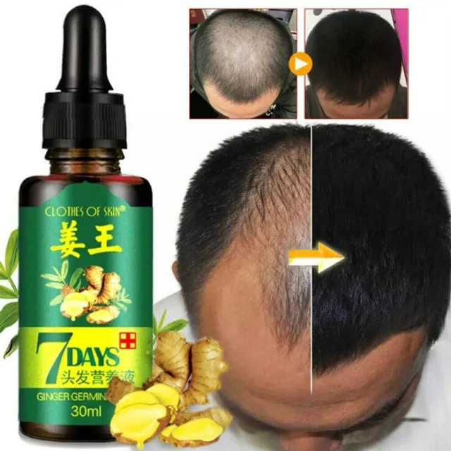 Sérum, huile au gingembre de croissance capillaire de cheveux pour homme et