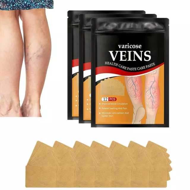 36 piezas parche para venas varicosas, tratamiento para venas varicosas para piernas, araña varicosas V