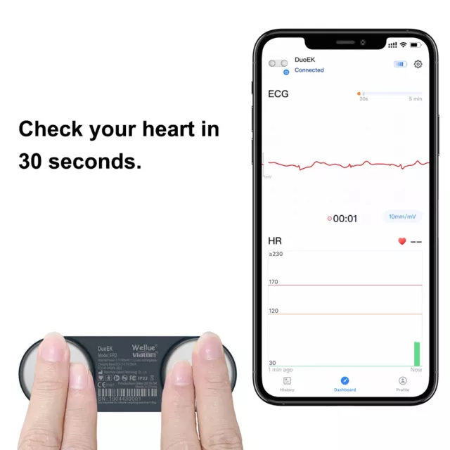 EKG/ECG Heart Monitor Wireless Heart Rate Monitor 15 Mins Monitoring free App 3