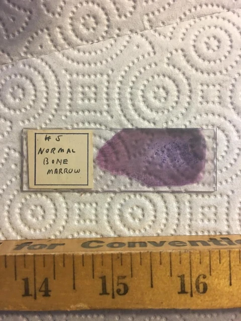 Antique Vintage Microscope Slide  "Normal Bone Marrow"