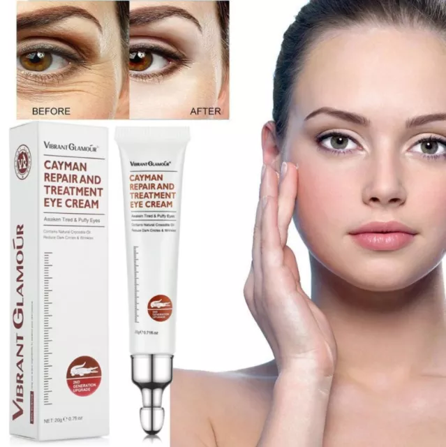 Magic Eye Cream Instant Remove Eye Bags Dark Circles Anti Wrinkle Depuffing Firm