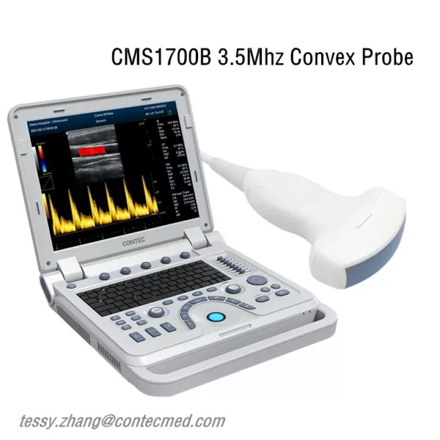 CMS1700B Color Doppler CF Ultrasound Scanner Machine USG Phased Convex Probe USG