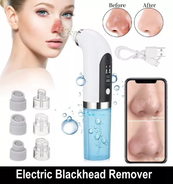 Electric Blackhead Remover Vacuum Pore Face Facial Suction Acne Cleaner Sucker