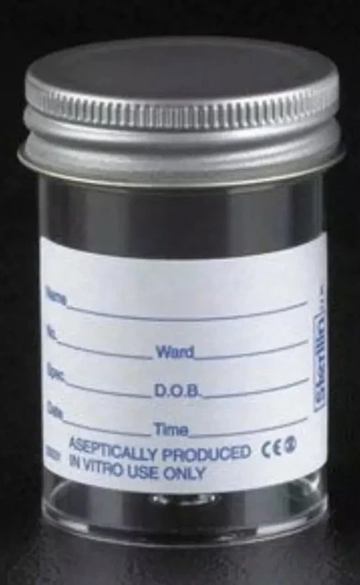 Raccogli Campioni Di Urina Per Cani E Animali Domestici - Cucchiaio Telescopico Regolabile Fino A 104 Cm - Materiale Acciaio Inox E PP - Per Cani, Gatti, Mucche - Foto 5