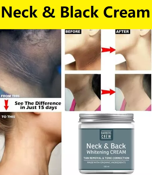 Dark Neck & Back Skin Instant Whitening Cream Reduce Hyperpigmentation & Melanin