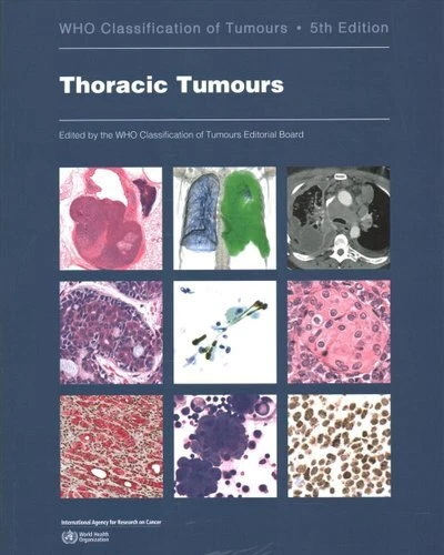 WHO WORLD HEALTH Organization Classification of Tumours 5 Thora ...