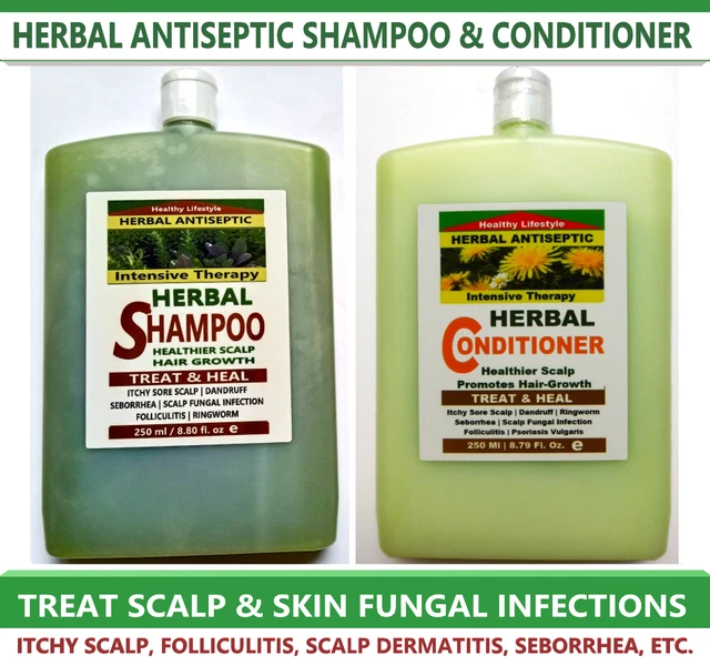 SCALP FUNGAL INFECTION Psoriasis Ringworm Folliculitis Shampoo
