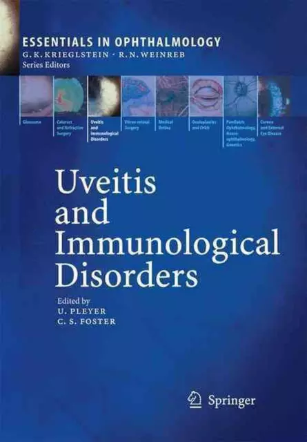 Uveitis and Immunological Disorders by Uwe Pleyer (English) Paperback Book