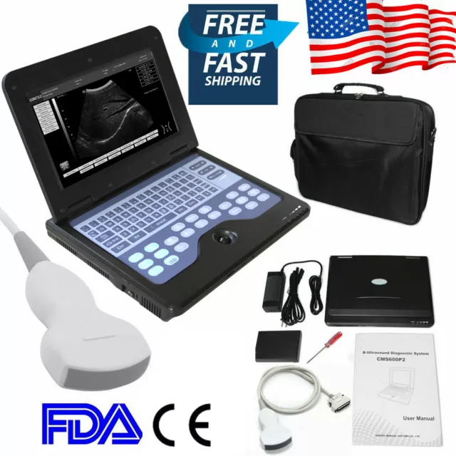 Portable Digital Ultrasound Machine B Ultrasonic Scanner Convex Abdominal Probe