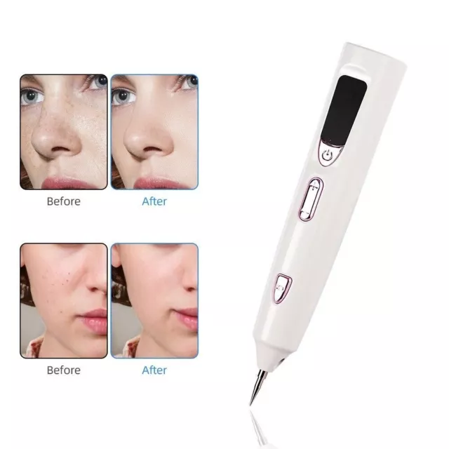 Tattoo Mole Removal Plasma Pen Laser Face Freckle Dark Spot Wart Remover Machine 3