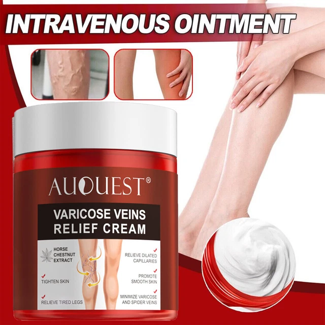 VARICOSE VEINS OINTMENT Cream Relief Pain For Vasculitis Phlebitis Gel
