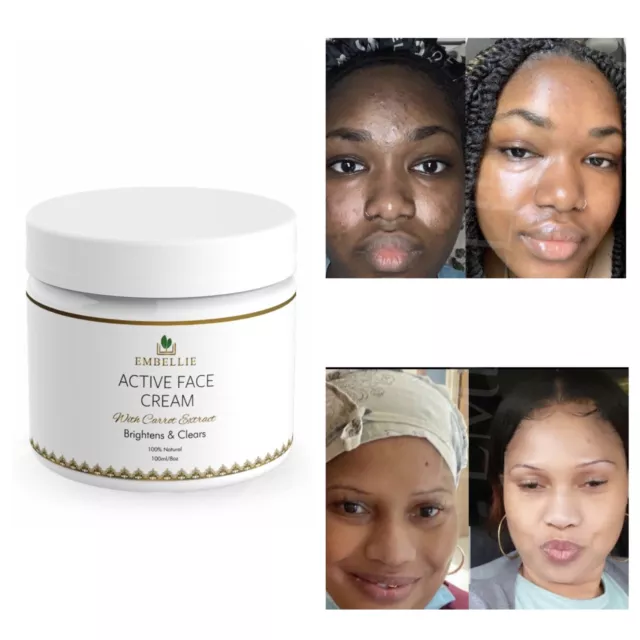 lightening face cream whitening cream brightening dark spots