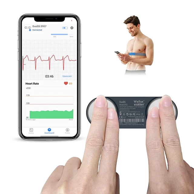 ECG Portatile Elettrocardiogramma, ViATOM Monitor ECG con Fascia Toracica, APP C