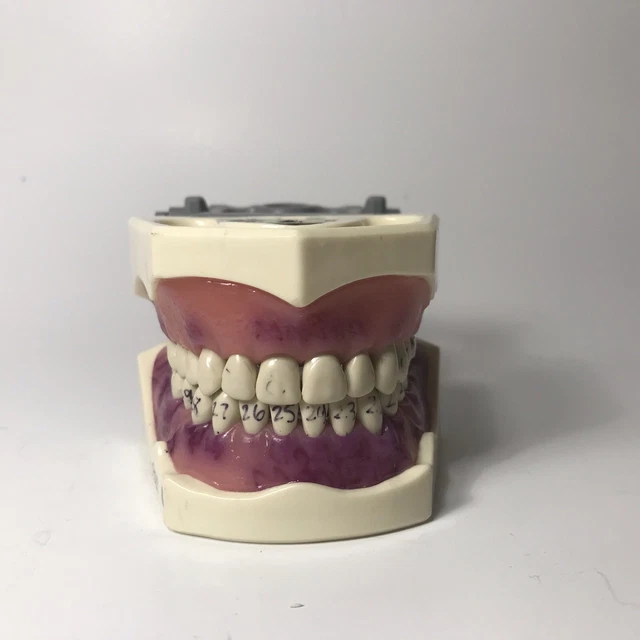 Columbia 860 Type Dental Typodont Diseased Gum Appearance Halloween Dentist Tool