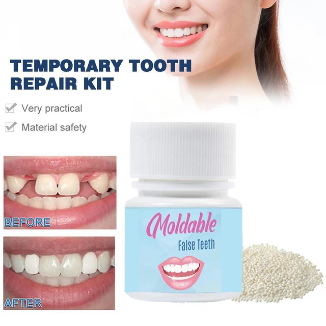 Tooth Repair Granules Temporary Tooth Repair Kit Fitting E Beads N Reusable I2F6