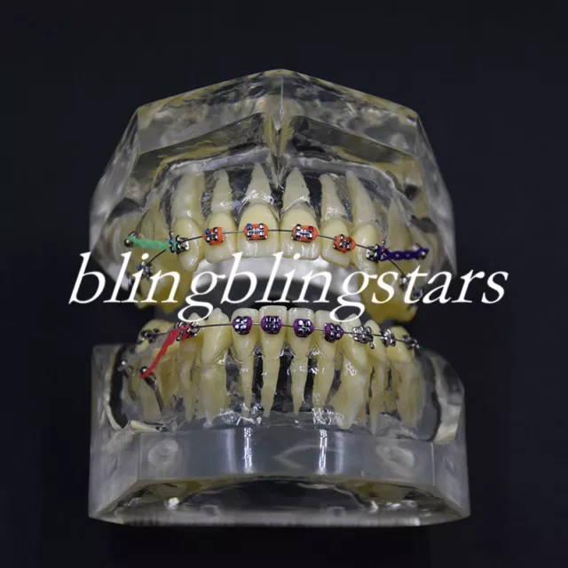 Dental Orthodontics Treatment Teeth Study Teach Model Bracket Chain Elastics