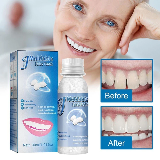 Granuli riparazione denti istantanea denti finti perline protesi temporanea rifacimento G2Y8