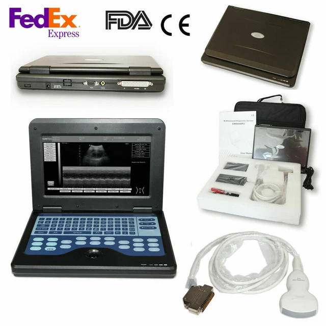 FDA Digital Portable Ultrasound Machine Laptop Scanner with 3.5Mhz Convex Probe