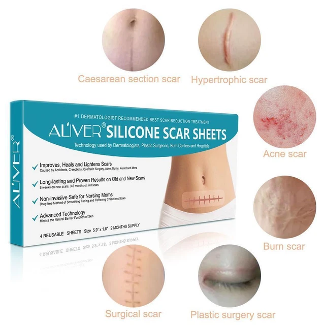 ALIVER 4x Rimuovi Cicatrici Gel Cicatrici Silicone Rimuovi Cicatrici J6A8 W4Y8 Riutilizzabile V4 O2K8