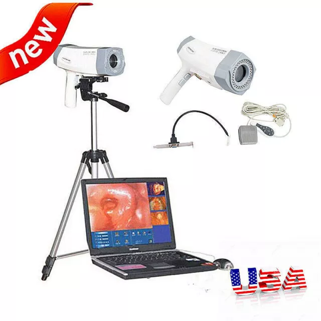 Portable Digital Electronic Colposcope 800000 Pixels Version Video+Tripod New