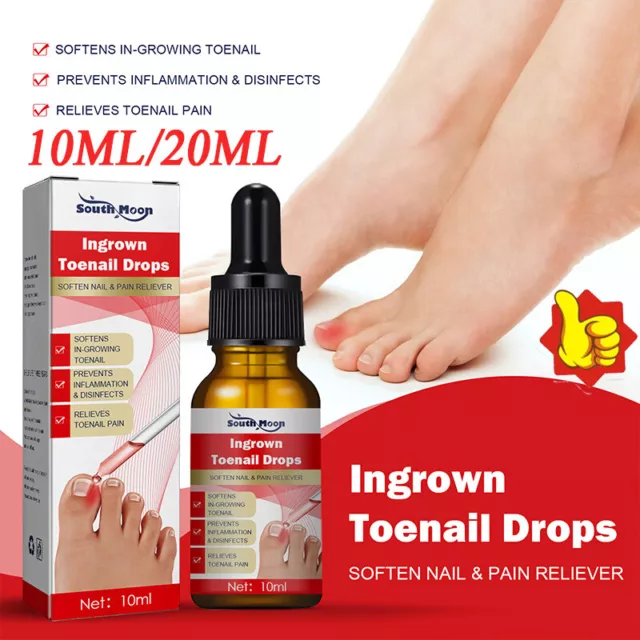 Ingrown Toenail Behandlung Serum Nagel Korrektion Recover Öl Schmerzen Helfer  ✨