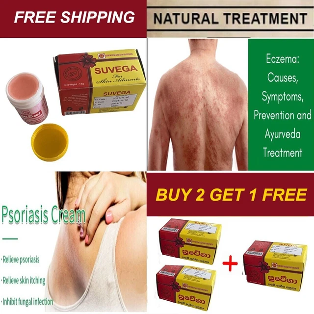 TINEA VERSICOLOR ANTIFUNGAL Treats Eczema Itch Skin Rash & Diseases
