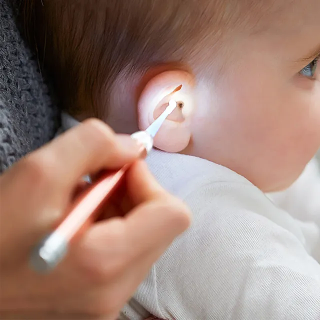 Limpiador de oídos para bebé Linterna LED Cera para oídos Curette Selector Auriculares Visuales.FW