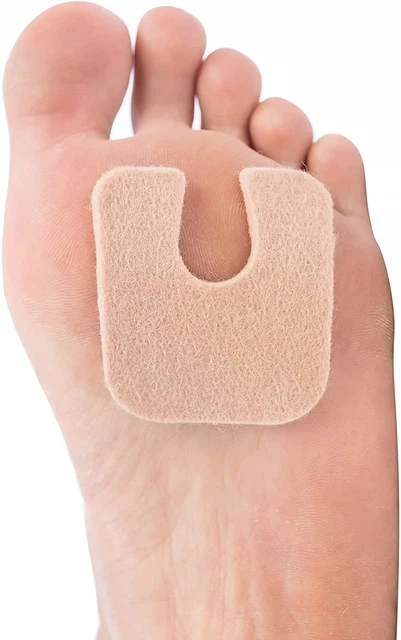 Zentoes U-Shaped Felt Callus Pads | Protect Calluses from Rubbing on Shoes | Red