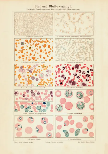 Blut und Blutbewegung I. historischer Druck Chromolithographie ca. 1903 Medizin