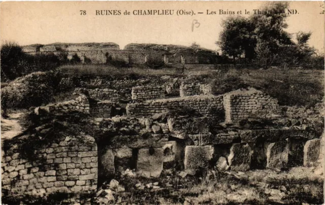 CPA Ruines de Champlieu-les-BAINS (423808)