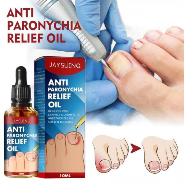 Anti-Paronychie-Behandlung Extra Starkes Zehennagelpilz-Athleten- 丷
