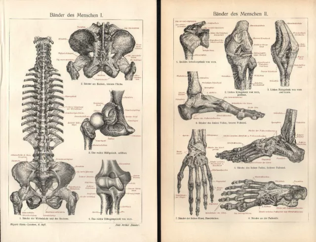 Bänder des Menschen Lithographie 1905 Orthopädie Kniegelenk Schulter Wirbelsäule