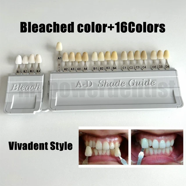 thumbnail interactive-video image 1 of Ivoclar 16-Color A-D Bleached Tooth Shade Guide – Dental Model 1 of 5