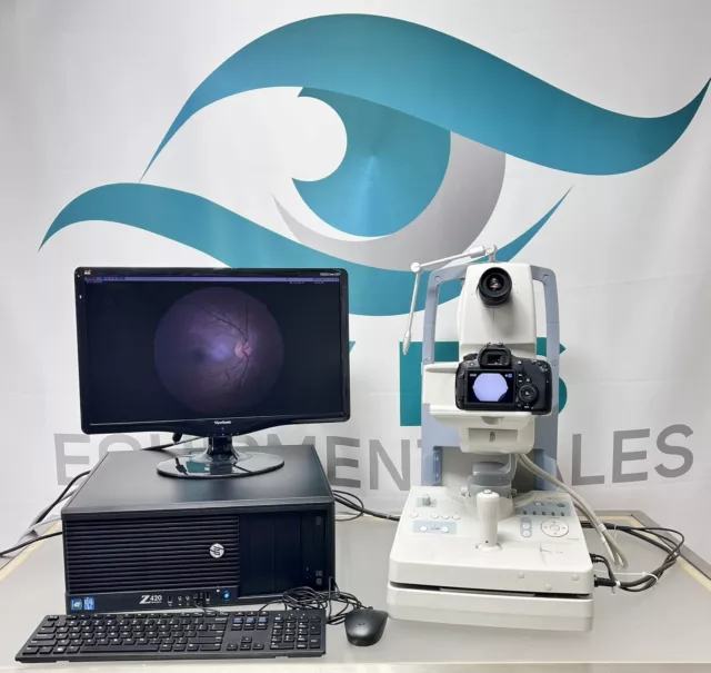 Canon CX-1 Mydriatic/ Non-Mydriatic Digital Retinal Camera MYD-NM w/ Computer