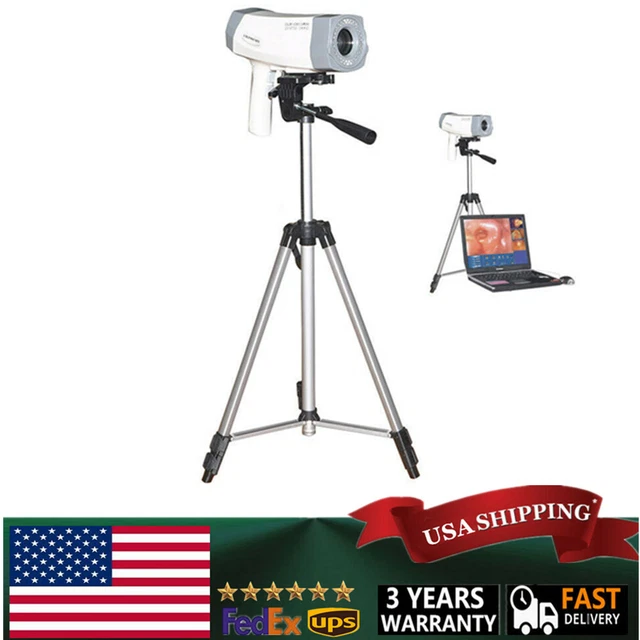 Carejoy Video Electronic Colposcope 480,000 Pixels Camera rvical Diagnosis