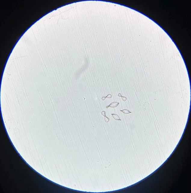19th c J.D. Moller Microscope Slide Diatom Norway Campylodiscus Spiralis Sm.