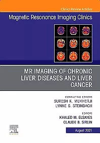 MR Imaging of Chronic Liver Diseases and Liver Cancer, An Issue of … Volume 29-3