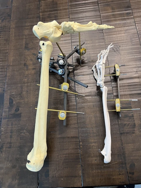 Distal Radius Forearm Wrist Leg Fixator Device Medical Training & Model Med
