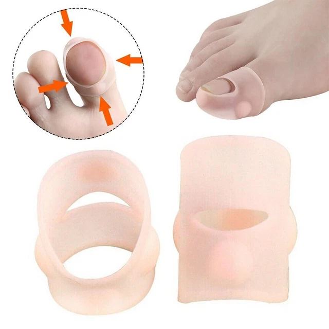 Nuevo Corrector de Corrección Suave Uña del pie Compresión de Silicona Invisible