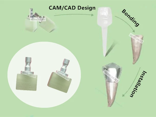 2Pcs Dental CAD CAM Fiber Blocks Post Core Block Glass Post-core Two-In-One