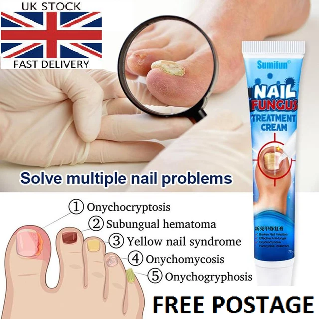 NAIL FUNGUS FUNGAL Removal Cream Treatment Care Onychomycosis Infection