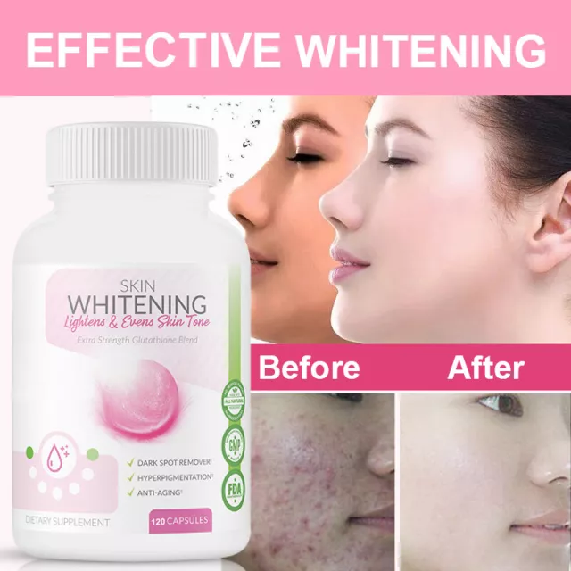 SKIN WHITENING GLUTATHIONE 1000mg Per Serve Brightening Lightening 120 Cap